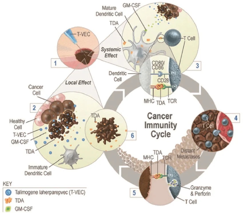 T-VEC Treatment for Melanoma: Harnessing a Virus to Fight Cancer